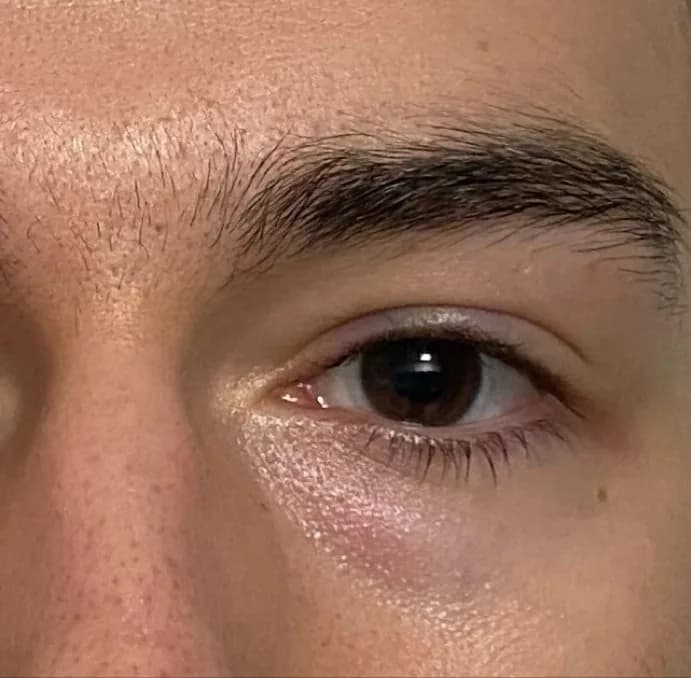Contour de l'œil avant utilisation de l'huile